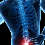 back pain treatment