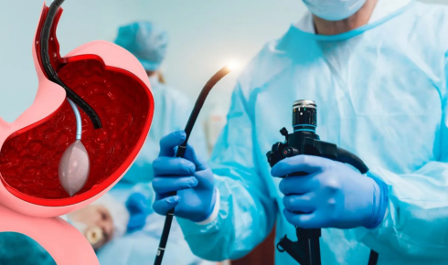 gastric balloon cost